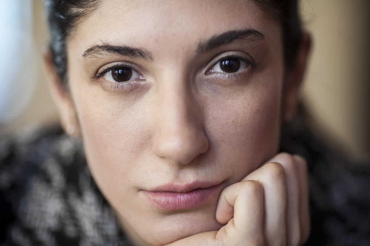 Radiesse midface restoration