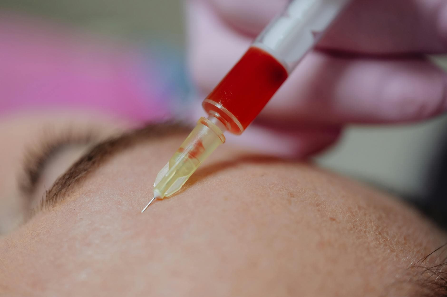 Botox treatment in progress