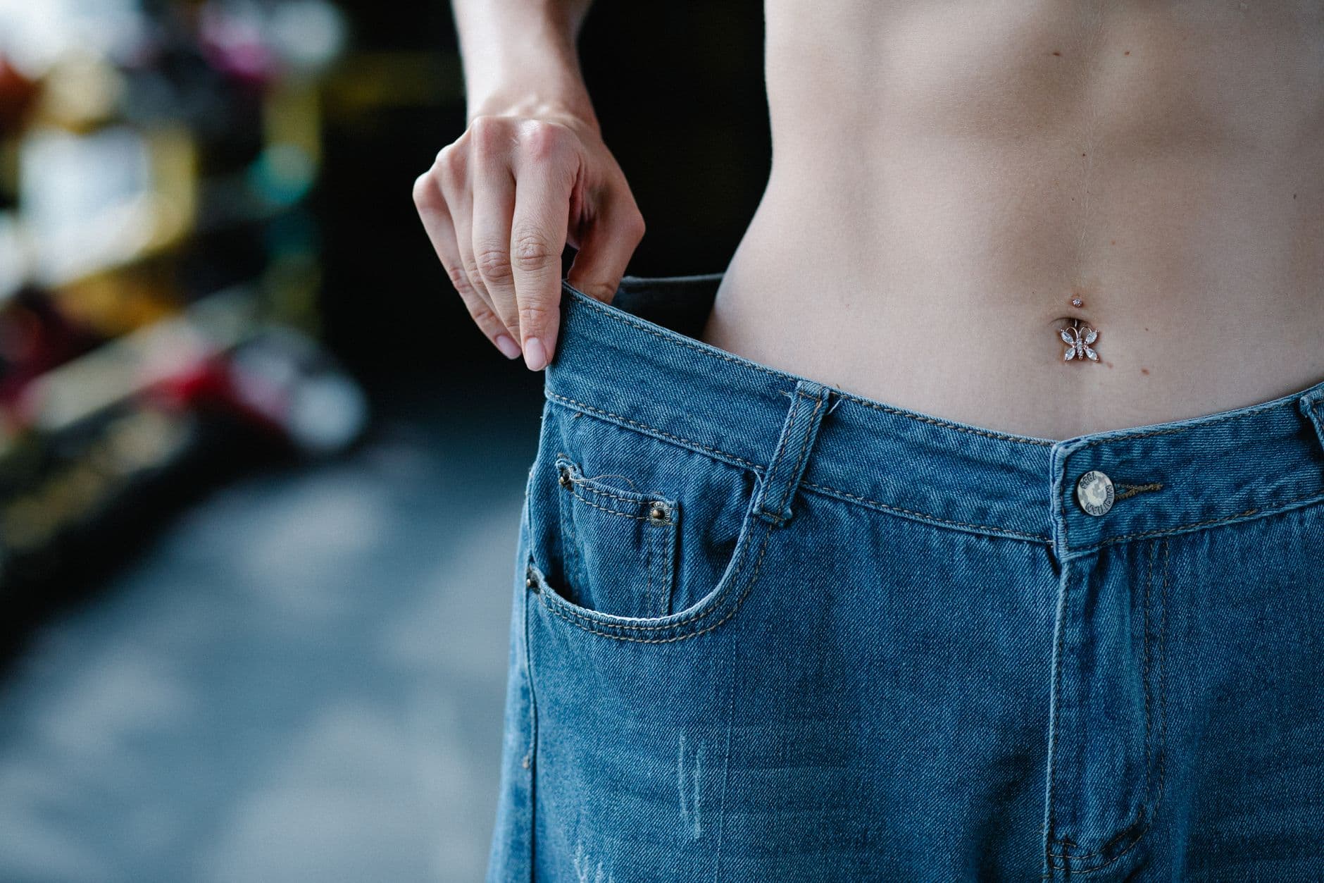 Excess skin removal as part of a tummy tuck