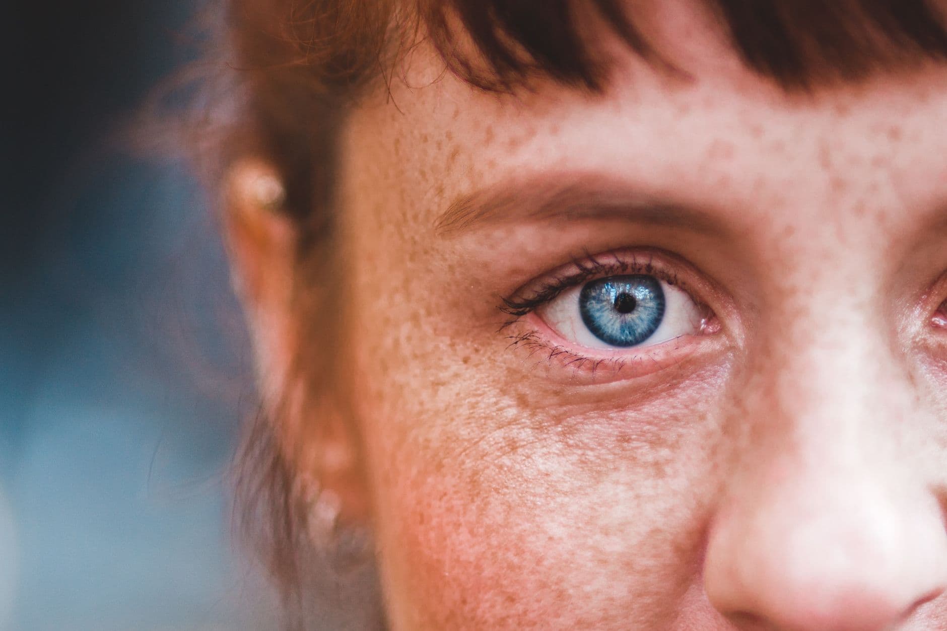 A patient considering blepharoplasty with confidence