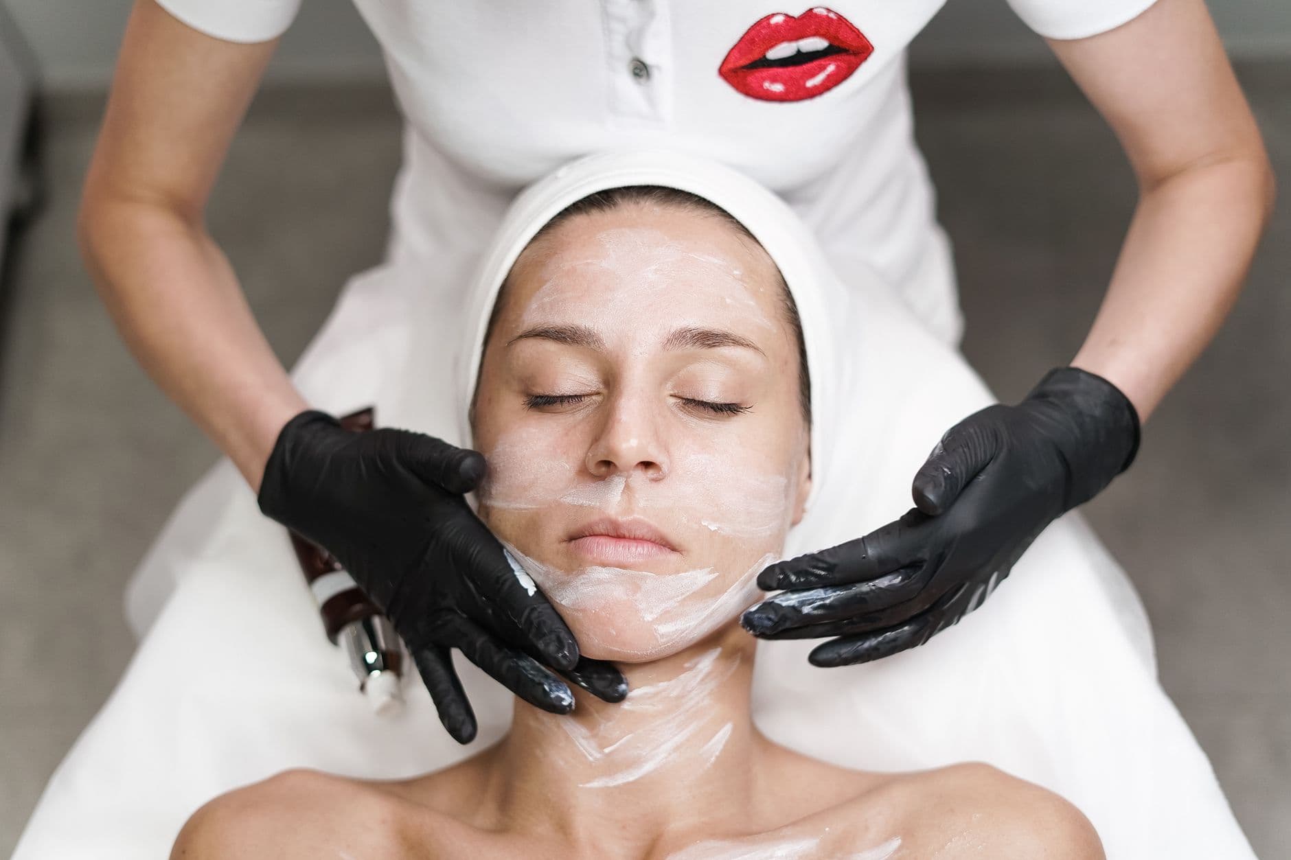 Microneedling & Chemical Peels treatment
