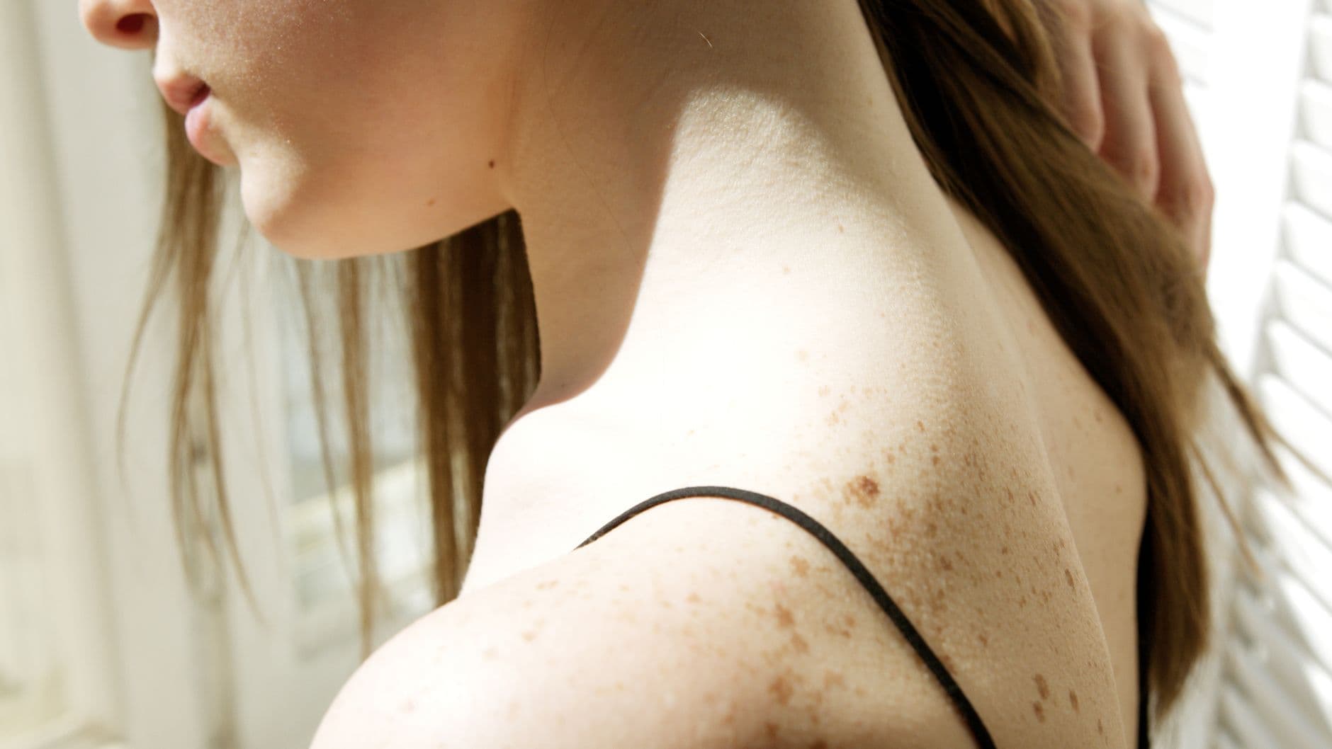 A woman considering neck liposuction and skin tightening