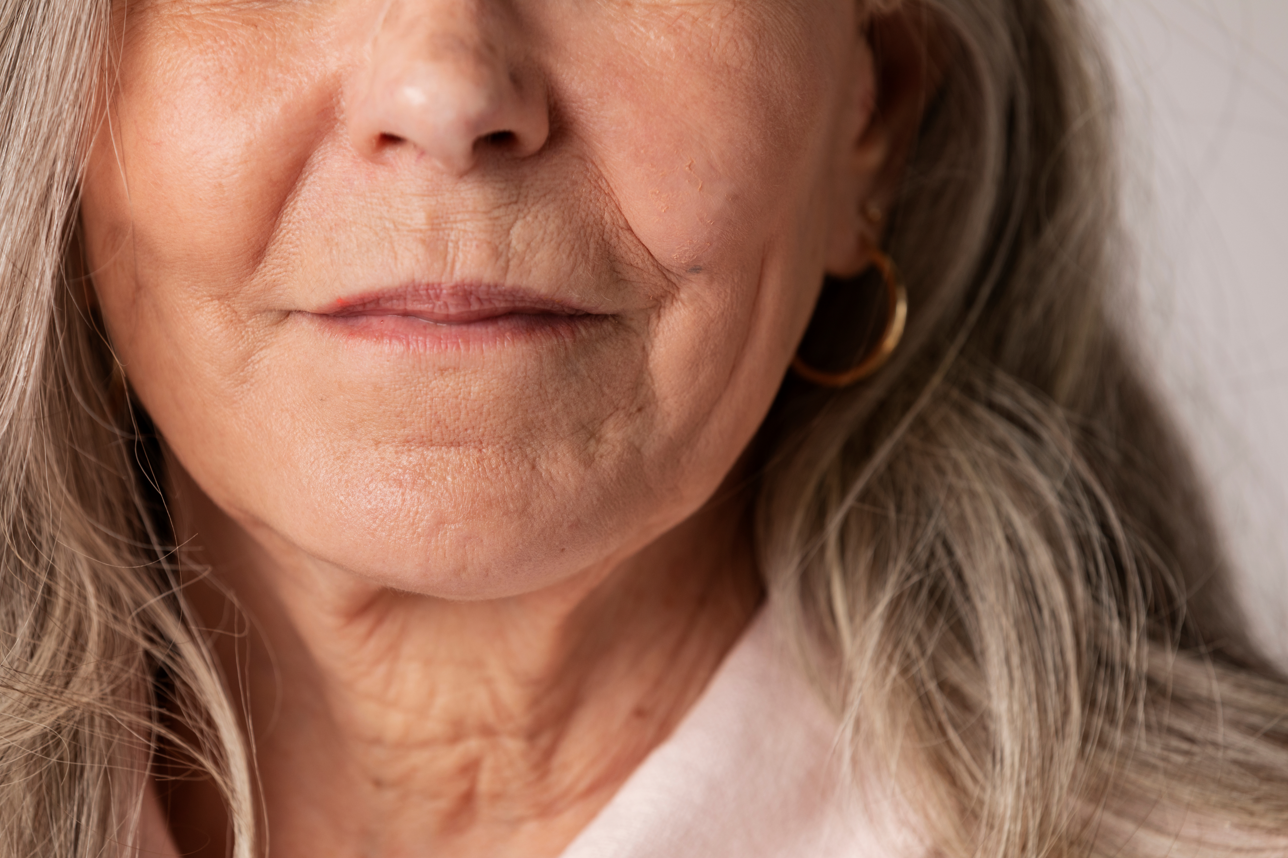 Wrinkles